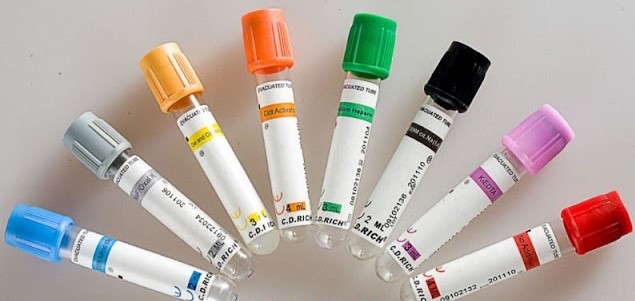 Importancia del correcto orden y llenado de los tubos de recolección de sangre