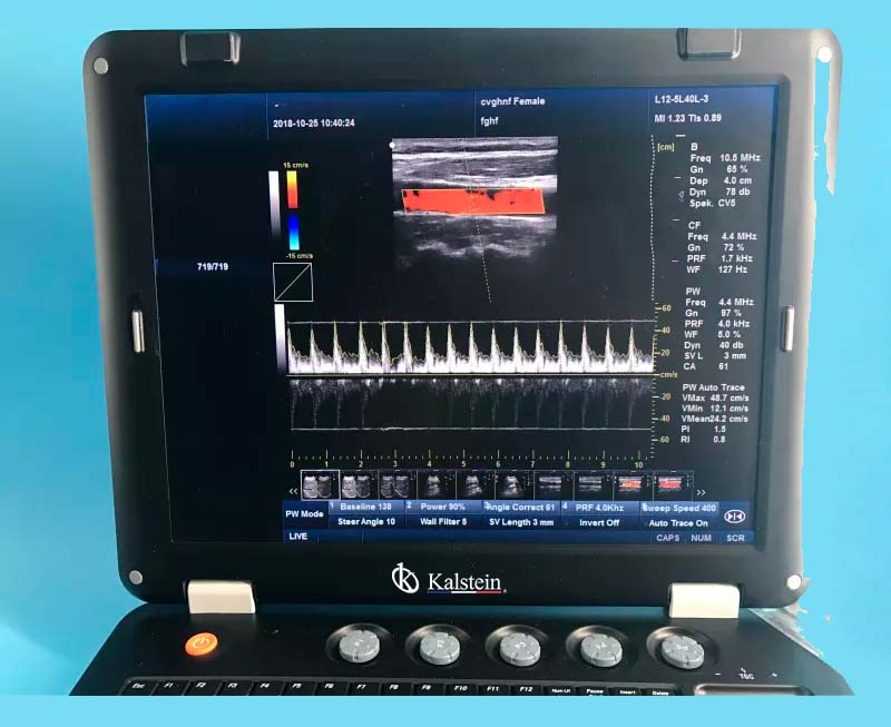 Máquina de ultrasonido THI médica 3D de 128 elementos a la venta con sonda convexa YR05148 – 1