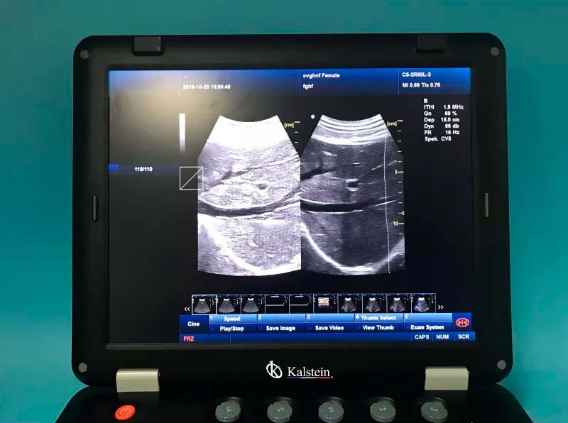 Máquina de ultrasonido THI médica 3D de 128 elementos a la venta con sonda convexa YR05148 – 2