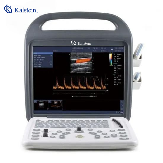 Comparativa de Doppler Veterinario: Kalstein YR06140 vs SonoScape S2V